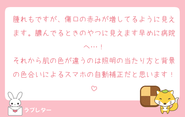 腫れもですが、傷口の赤みが増してるように見えます。膿んでるときのやつに見えます早めに病院へ…！
それから肌の色が違うのは照明の当たり方と背景の色合いによるスマホの自動補正だと思います！